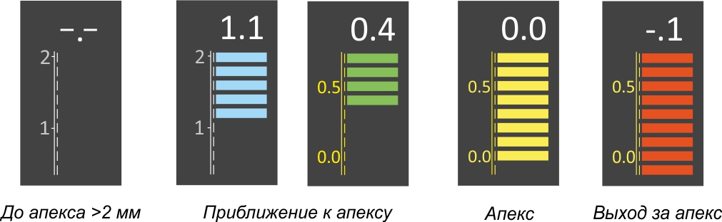 MaestroD интерфейс апекслокатора